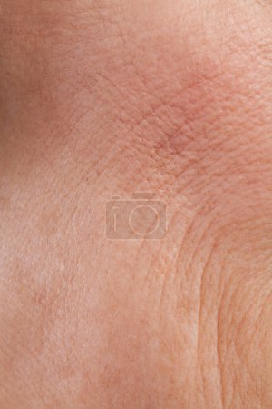 Foto de Textura de la piel, primer plano, cuidado de la piel, arrugas, poros - Imagen libre de derechos