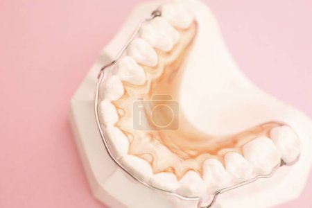 Téléchargez les photos : Modèle dentaire et dispositif de retenue en métal sur fond rose - en image libre de droit