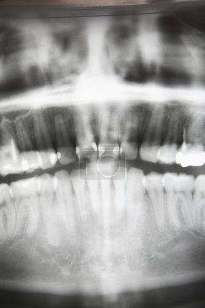 Téléchargez les photos : Radiographie des dents. dents de la mâchoire - en image libre de droit