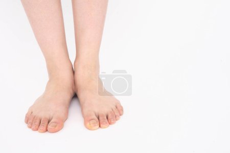 Photo for Female feet on white background. - Royalty Free Image