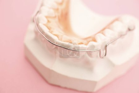 Téléchargez les photos : Modèle dentaire et appareil de retenue en métal, vue rapprochée - en image libre de droit
