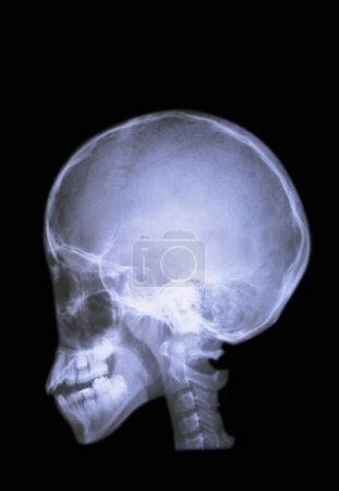 Foto de Anatomía cerebral x - rayos sobre el fondo, primer plano - Imagen libre de derechos