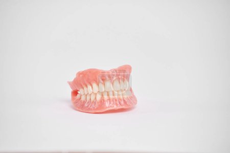 Foto de Dental prostheses on a white background. Beautiful teeth ceramic press ceramic crowns and veneers. Dental restoration treatment clinic patient. Oral surgery dentist - Imagen libre de derechos