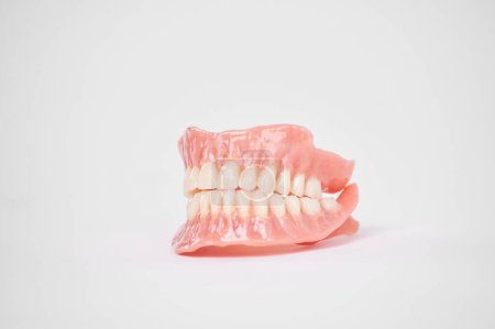 Foto de Dental prostheses on a white background. Beautiful teeth ceramic press ceramic crowns and veneers. Dental restoration treatment clinic patient. Oral surgery dentist - Imagen libre de derechos