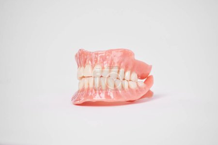 Zahnprothesen auf weißem Hintergrund. Schöne Zähne Keramik pressen keramische Kronen und Veneers. Zahnrestaurationsbehandlung Klinik Patient. Zahnarzt für Oralchirurgie