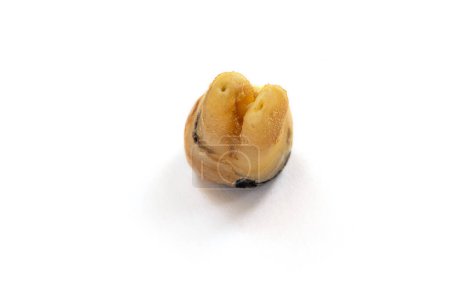 Téléchargez les photos : Une dent de gros plan avec une carie dentaire sévère également connue sous le nom de caries dentaires ou de caries dues à une mauvaise hygiène buccodentaire, isolée sur fond blanc - en image libre de droit