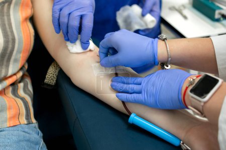 Photo for Blood donation, two nurses in blue gloves connect the collection system with a needle to the patient's left arm, the donor is sitting in a chair in a medical facility, no face, medium close-up - Royalty Free Image