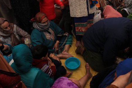 Téléchargez les photos : 21 mars 2024 à Kashimir, Inde : Une personne reçoit une thérapie de sangsue, toujours populaire au CachemirOn croit que les sangsues peuvent guérir les maladies de la peau et d'autres infections sanguines en extrayant le sang impur du corps - en image libre de droit