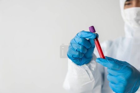 Foto de El médico del hospital sostiene la prueba de vasos sanguíneos en el laboratorio con la muestra de sangre del estante con el analizador en el laboratorio - Imagen libre de derechos