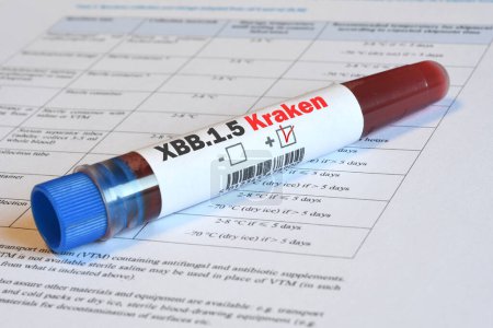 Blood tube for test detection of virus Covid-19 XBB.1.5 Kraken Variant with positive result on papers document.