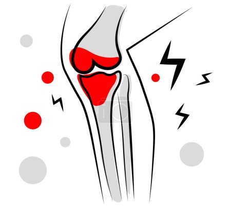Knee pain. Vector illustration