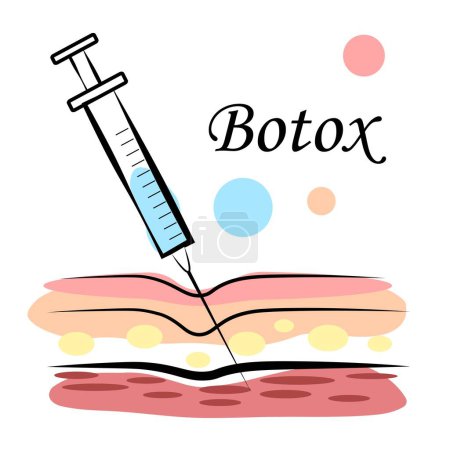 Inyecciones de toxina botulínica para rejuvenecimiento. Ilustración vectorial