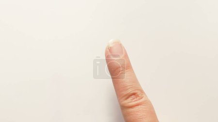 Zeigefinger mit rissigem und wunder Nagel
