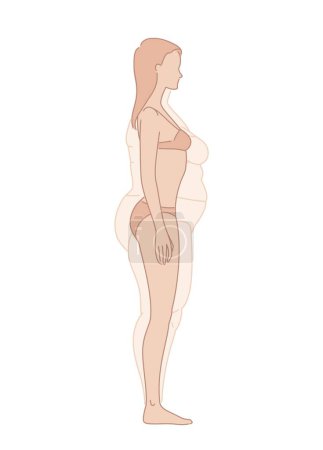 Ilustración de Pérdida de peso corporal antes y después de la dieta. Transformación de la Emaciación. Silueta femenina obesa con sobrepeso. salud. Cinco ángulos frente a la figura, 3 de 4, vistas laterales. Ilustración vectorial - Imagen libre de derechos