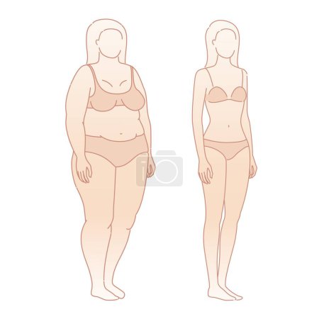 Gewichtsverlust der Frau vor und nach der Diät. Abmagerung Transformation. Übergewichtige übergewichtige weibliche Silhouette. Gesundheitsform. Fünf Winkeln Figur vorne, 3 von 4, Seitenansichten. Vektorillustration