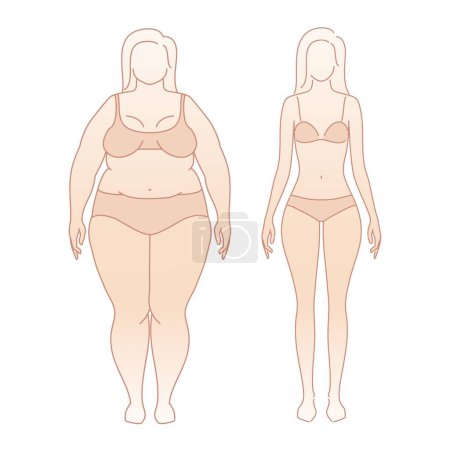 Woman body weight loss before and after diet. Emaciation Transformation. Overweight obese female silhouette. health shape. Five angles figure front, 3 of 4, side views. Vector illustration
