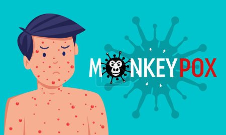 Illustration for Monkeypox virus banner for awareness and alert against disease spread, symptoms or precautions - Royalty Free Image