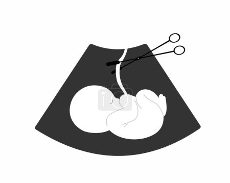 Fötus-Baby mit abgeschnittener Nabelschnur mit chirurgischer Pinzette nach Fehlgeburt oder Schwangerschaftsabbruch