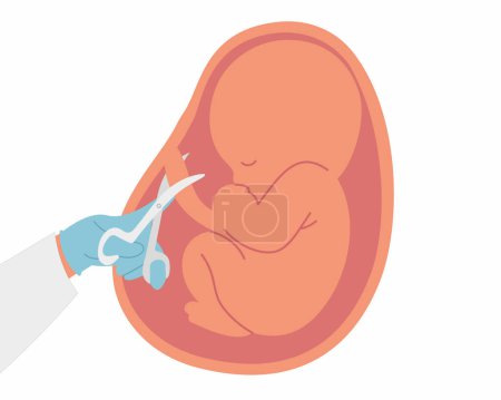 doctor cutting the umbilical cord after doctor successfully deliver a baby vector illustration