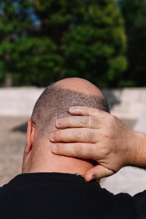 Photo for Close-up rear view of a male head with thinning hair or alopecia with one hand on the nape of his neck - Royalty Free Image