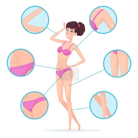 Illustration for Woman depilation. Female body hair removal armpits and waxing vector cartoon infographics. Illustration depilation skin, perfect skincare and clear - Royalty Free Image