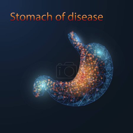 Illustration for Acid Reflux, Heartburn, GERD, Gastritis. Humans suffer from heartburn. Low polygons, triangles, wireframe, and particle style. - Royalty Free Image