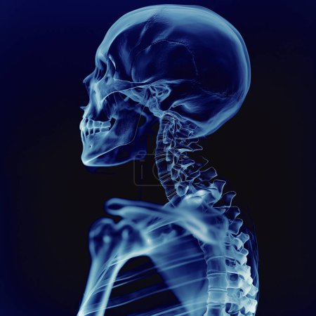 Película de rayos X de cráneo y columna vertebral sobre fondo azul oscuro, vista lateral
