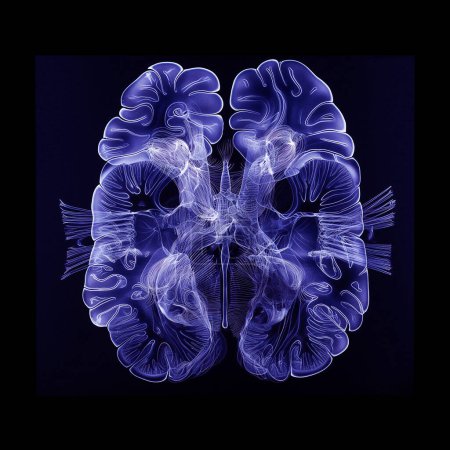 Röntgenfilm des menschlichen Gehirns auf dunklem Hintergrund, Draufsicht, Gesundheits- und Medizinkonzept.