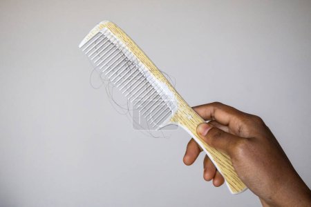 Woman hand is holding a comb with fallen hair. Hair loss is not usually a cause for concern, but it can sometimes be a sign of a medical condition. The concept of androgenetic alopecia and hair loss.