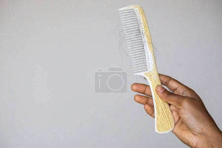 Woman hand is holding a comb with fallen hair. Hair loss is not usually a cause for concern, but it can sometimes be a sign of a medical condition. Androgenetic alopecia and hair loss concept.