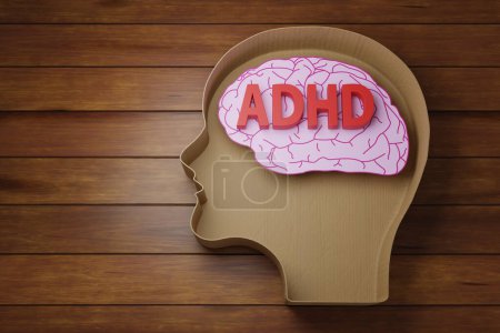 Red letters ADHD on pink brain paper cut in human head shaped brown cardboard container on wooden table. Illustration of the concept of attention deficit hyperactivity disorder