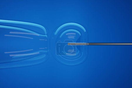 Injektion von Stammzellen in einen transparenten Embryo durch eine scharfe silberne Nadel vor blauem Hintergrund. Illustration des Konzepts der gezielten Mikroinjektion embryonaler Stammzellen (ES)