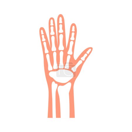 Menschliches Handgelenk und Handfläche mit Knochen und Gelenken wie im Röntgenbild, medizinische Diagramm-Vektor-Illustration