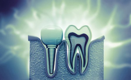Photo for Dental implement on abstract medical background. 3d illustration - Royalty Free Image