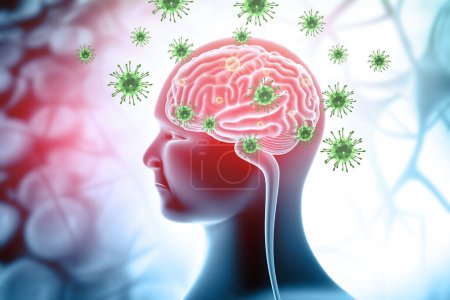 Foto de Infección por virus en el cerebro. Formación médica. ilustración 3d - Imagen libre de derechos