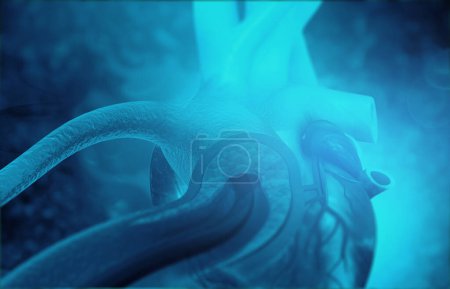 Photo for Human heart angioplasty. 3d illustration - Royalty Free Image