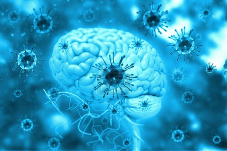 Virusinfektion im Gehirn. 3D-Illustration