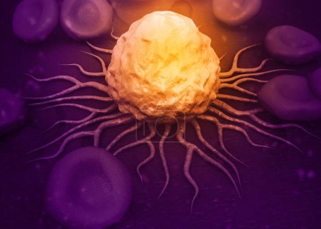 Foto de Células cancerosas en ciencias médicas. ilustración 3d - Imagen libre de derechos