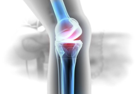Photo for Anatomy of the Knee Joint. 3d illustration - Royalty Free Image