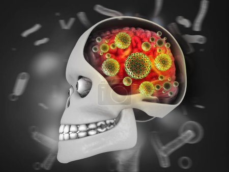 Foto de Virus atacando el cerebro humano. ilustración 3d - Imagen libre de derechos
