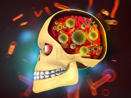 Photo for Virus attacking humans brain. 3d illustration - Royalty Free Image