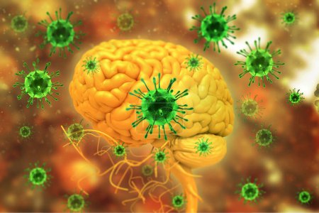 Foto de Infección por virus en el cerebro. ilustración 3d - Imagen libre de derechos