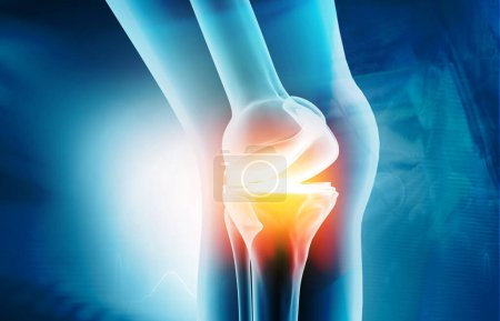 Foto de Anatomía de la articulación de la rodilla en el fondo médico. ilustración 3d - Imagen libre de derechos