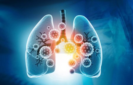 Viral lung infections, lung infection conept. 3d illustration	