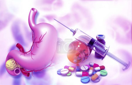 Foto de Anatomía del estómago con la medicina farmacéutica. frasco de vidrio, pastillas y una jeringa. ilustración 3d - Imagen libre de derechos