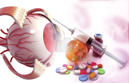 Foto de Anatomía del ojo con medicina farmacéutica. frasco de vidrio, pastillas y una jeringa. ilustración 3d - Imagen libre de derechos