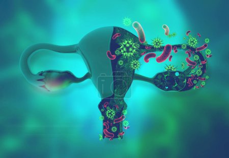 Foto de Bacterias virales con anatomía uterina femenina. ilustración 3d - Imagen libre de derechos