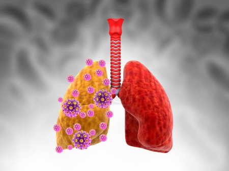 Photo for Human lungs with virus on medical background. 3d illustration - Royalty Free Image
