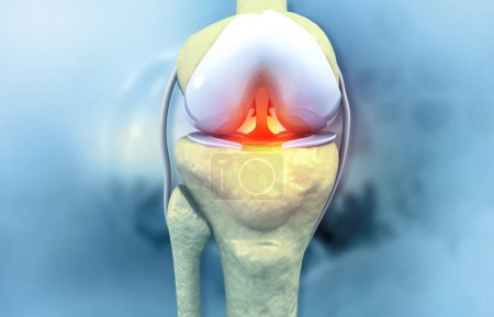 Photo for Human knee pain. knee joint. 3d illustration - Royalty Free Image