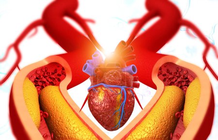 Téléchargez les photos : Anatomie cardiaque humaine et artères obstruées. Illustration 3d - en image libre de droit